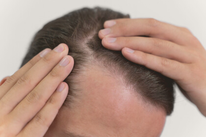 how can we help - hair loss